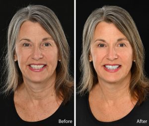 photographic retouching samples before and after portrait headshots
